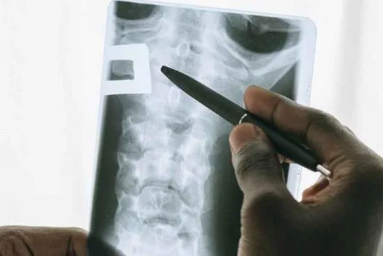 Indications for funnel chest surgery 2026 Indications for funnel chest surgery 2026