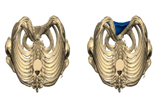 Diagnosis of pectus excavatum 2026 Diagnosis of pectus excavatum 2026